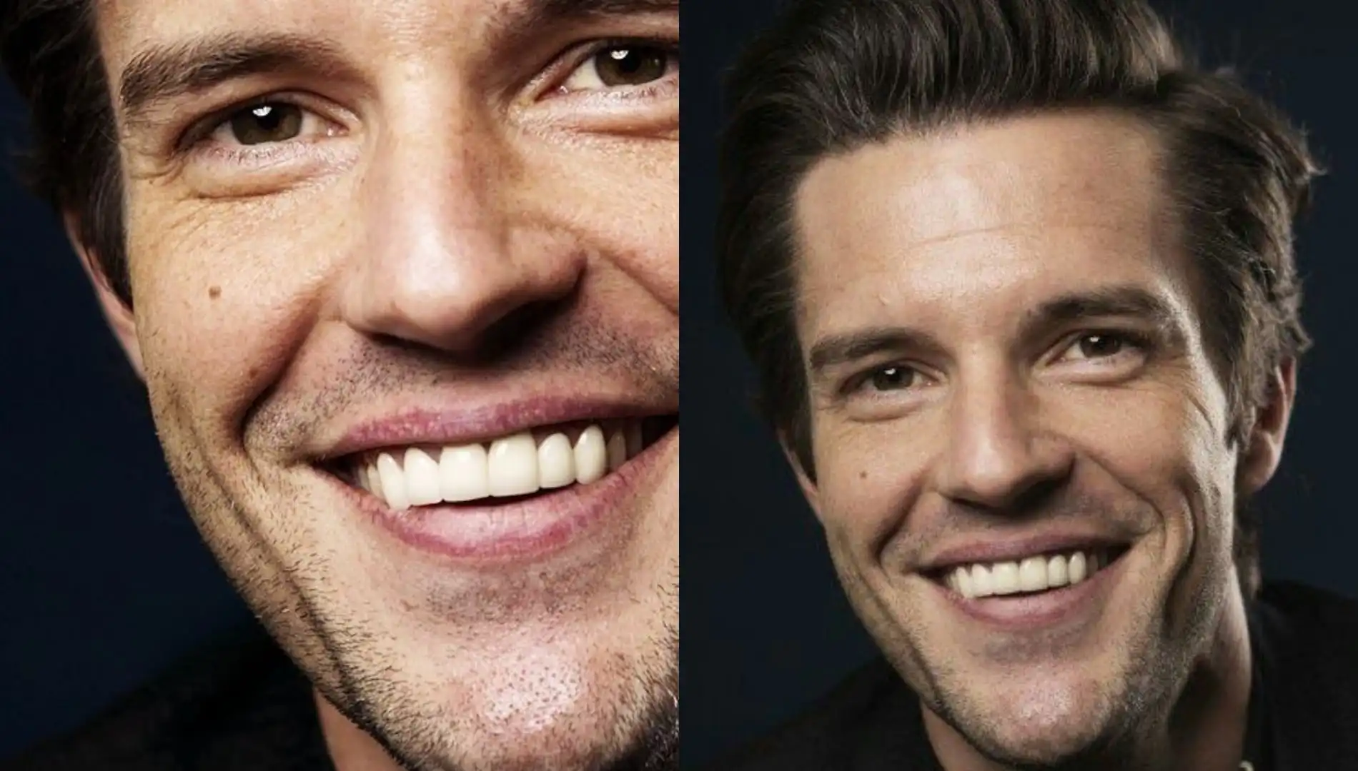 Brandon Flowers teeth before and after