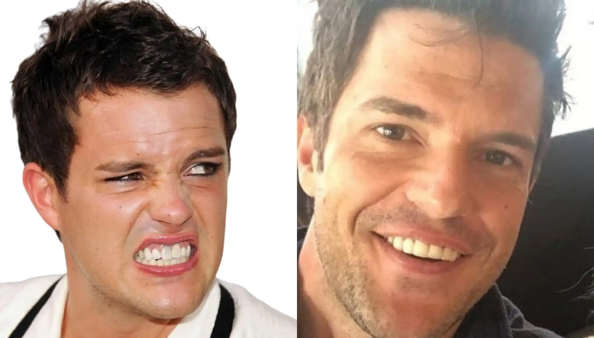 Brandon Flowers' teeth transformation