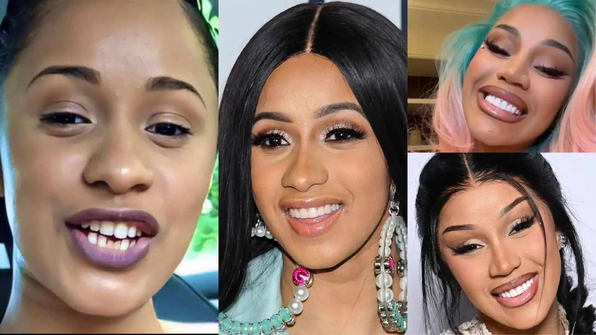Cardi B teeth veneer