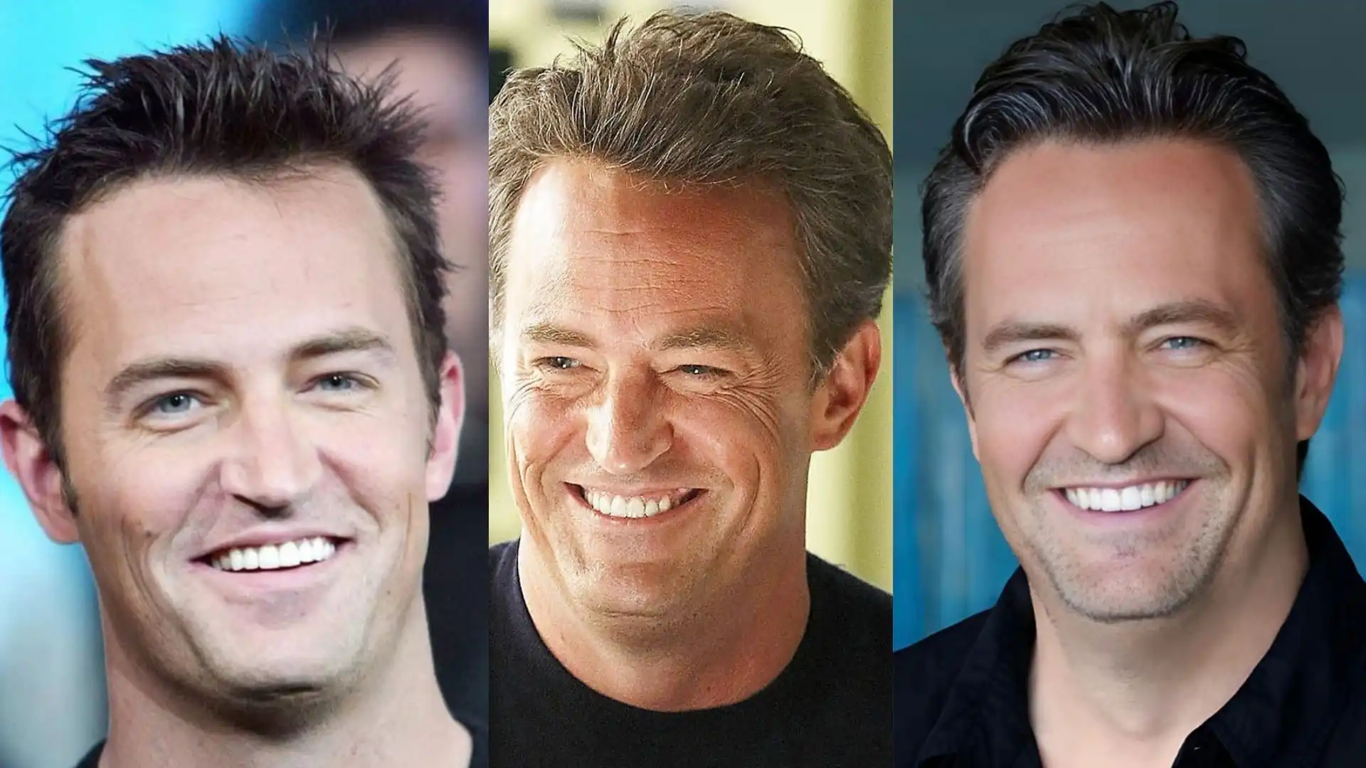 Matthew Perry teeth veneer