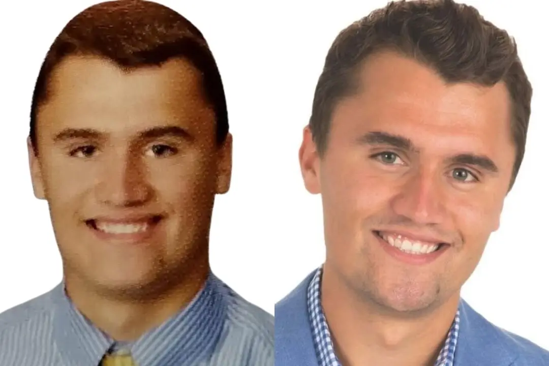 Charlie Kirk's smile before after