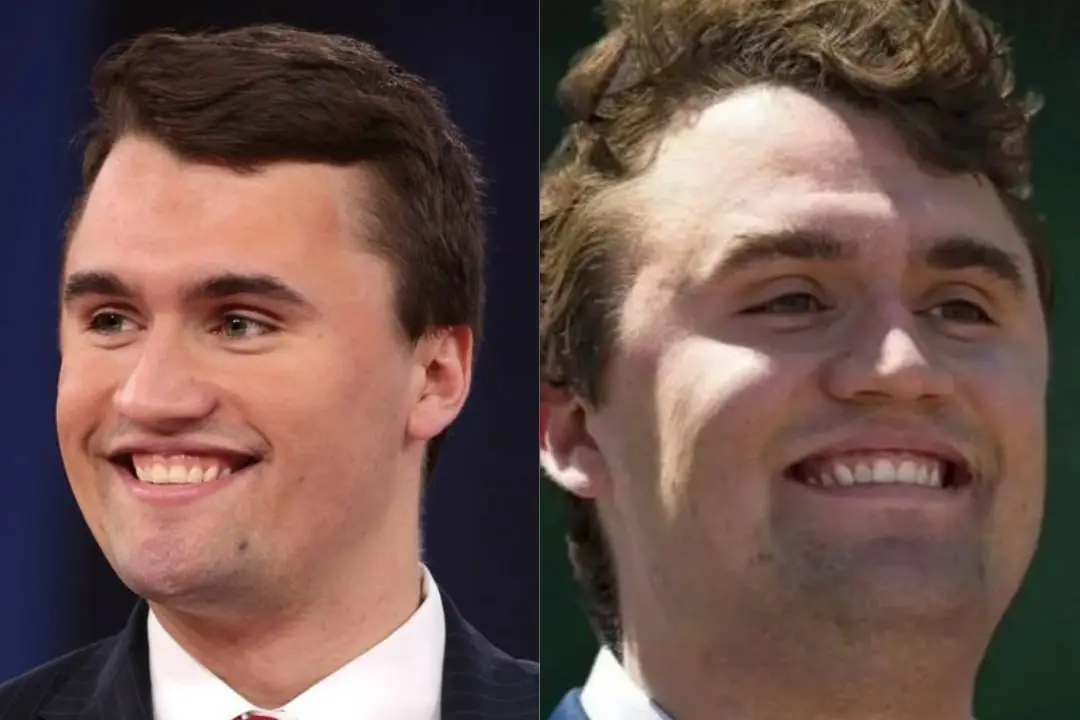 Charlie Kirk's smile before after