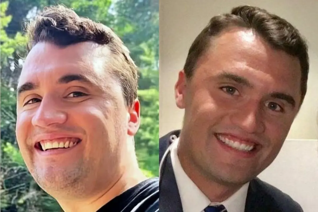 Charlie Kirk's smile before after