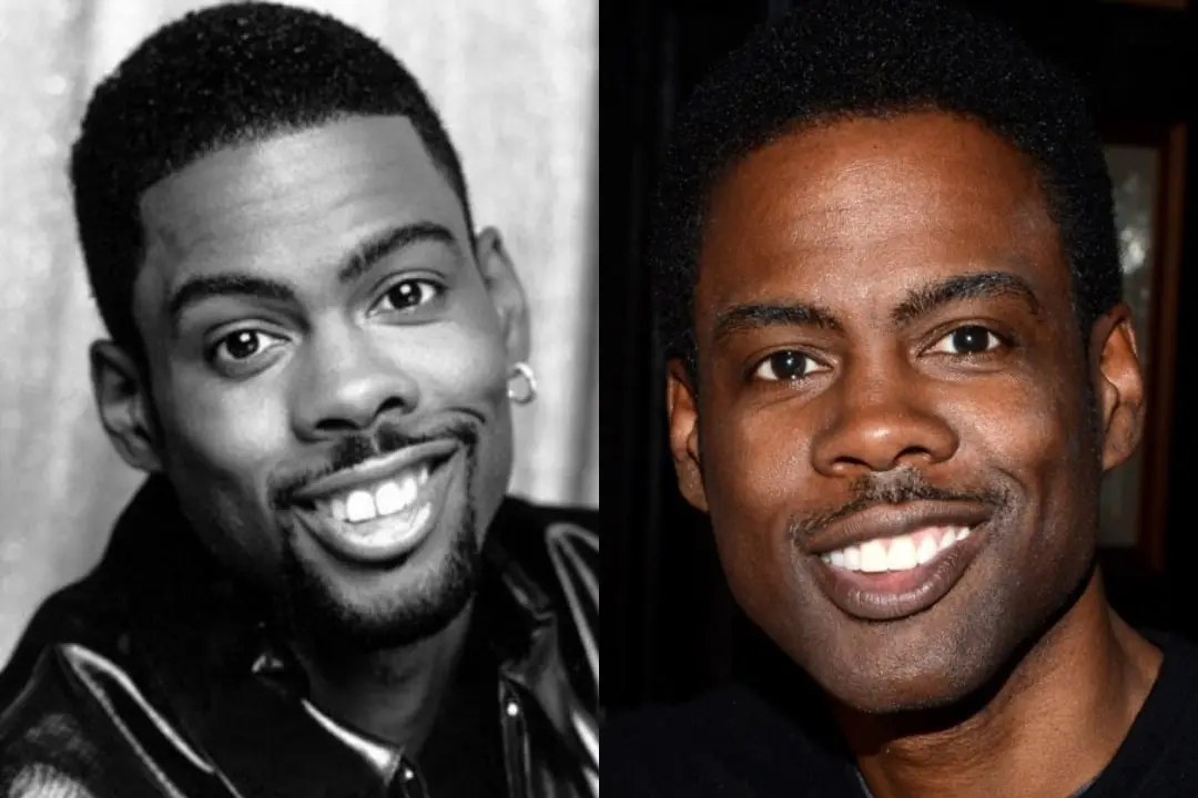 Chris Rock dental implant before after