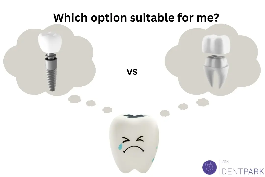 Crown vs Implant: Which option suitable for me?