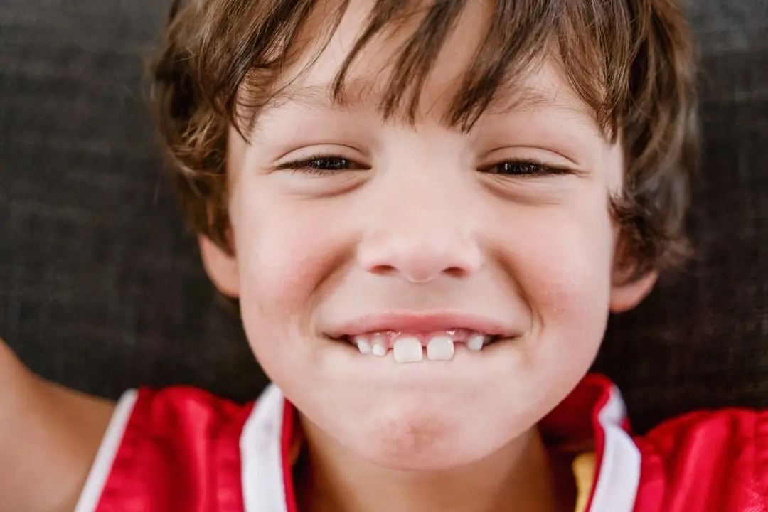 Gappy teeth in children