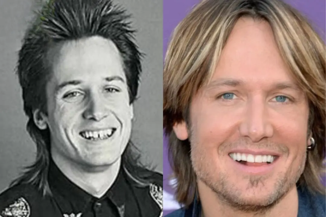 Keith Urban teeth before after