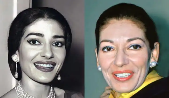 Maria Callas's teeth before after