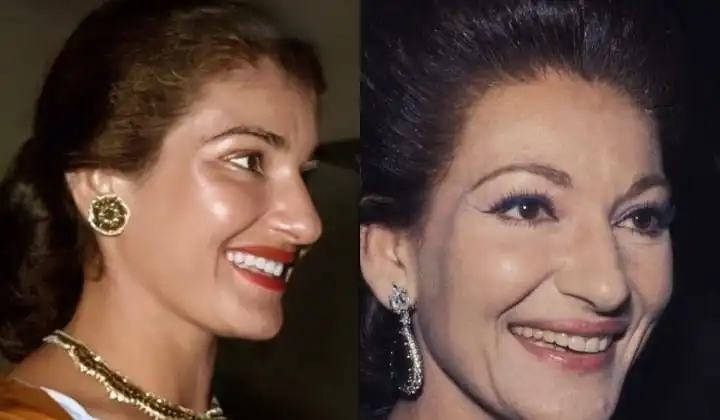 Maria Callas's teeth before and after
