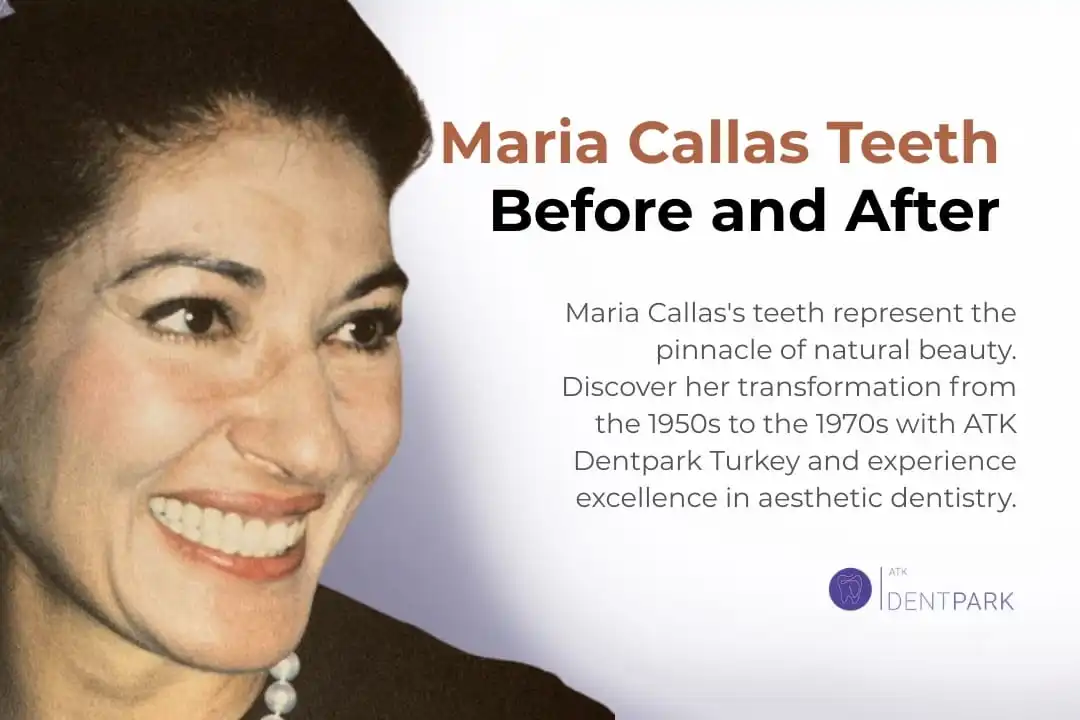 Maria Callas Teeth Before and After