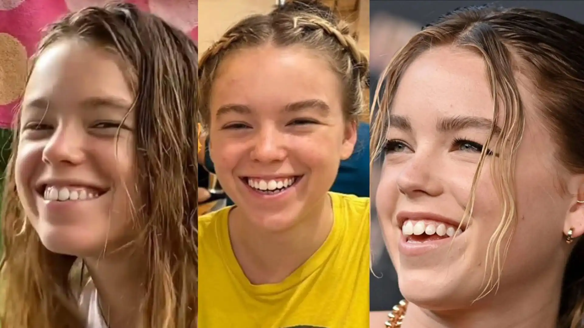 Milly Alcock's teeth before and after-1