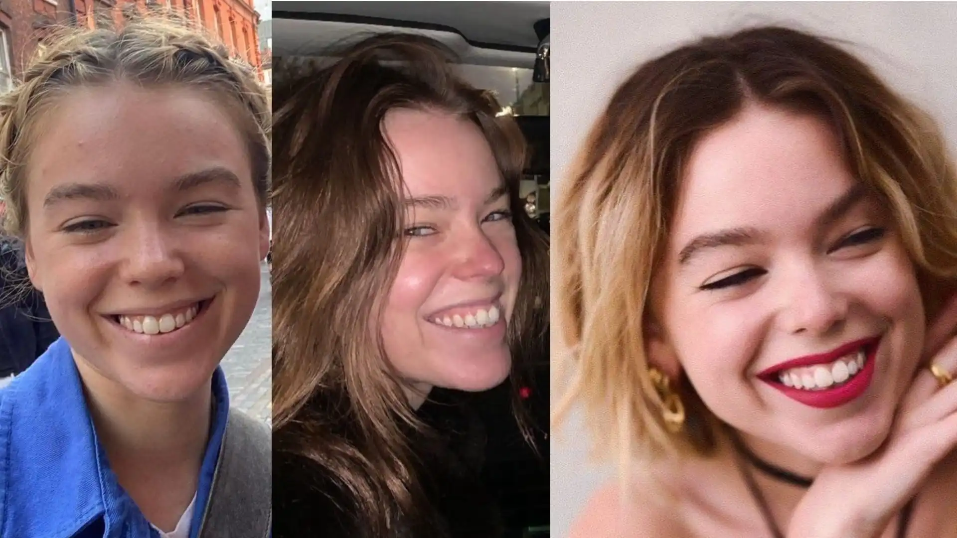 Milly Alcock's teeth before and after-2