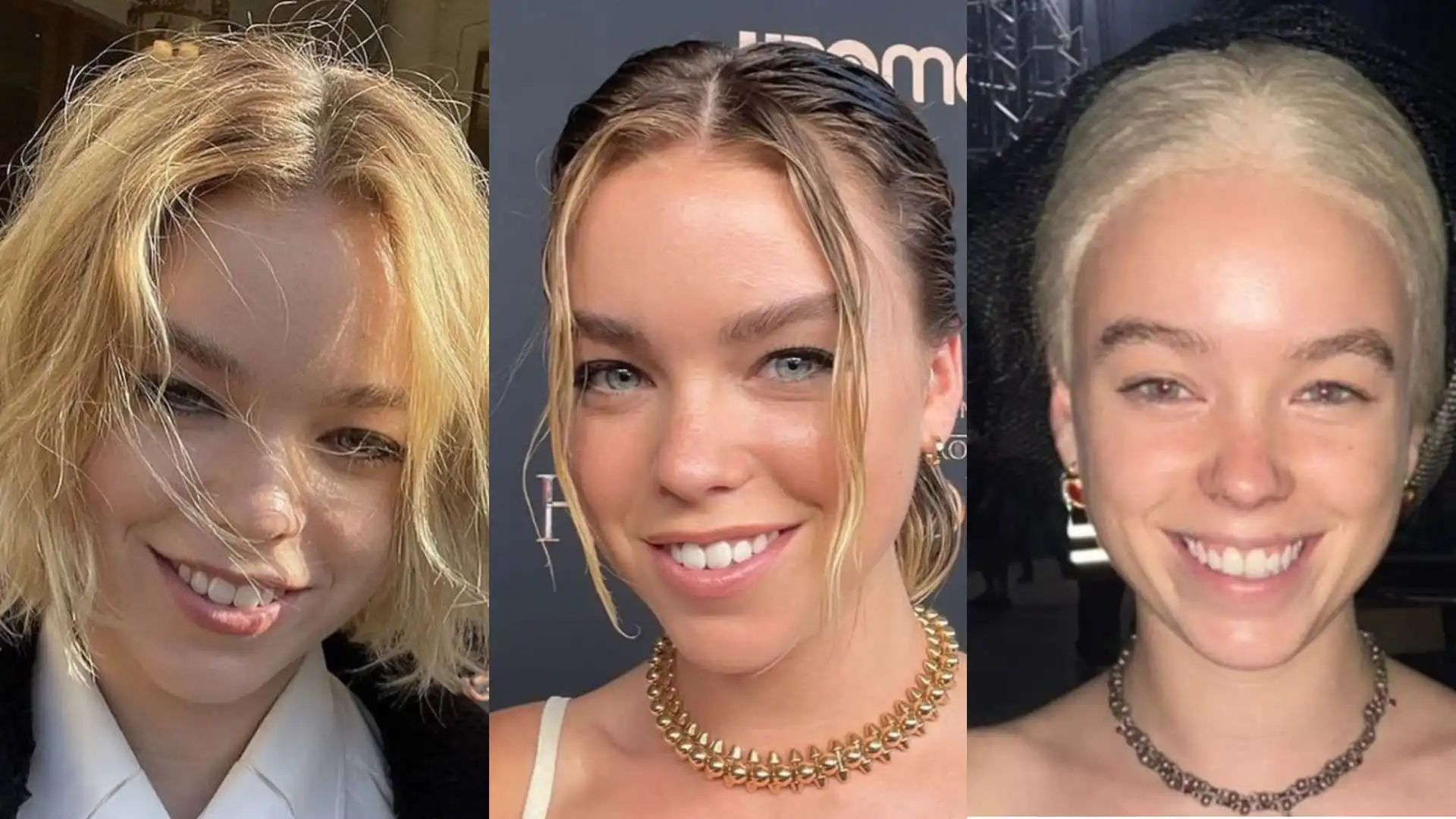 Milly Alcock's teeth before and after-3