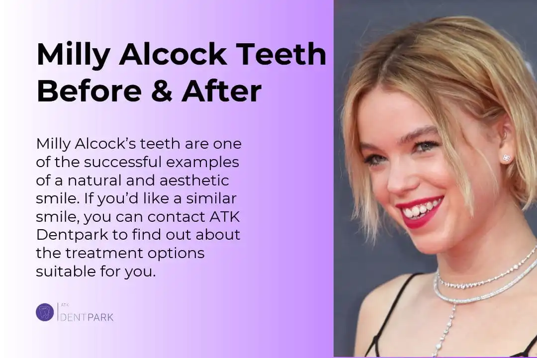 Milly Alcock Teeth Before & After