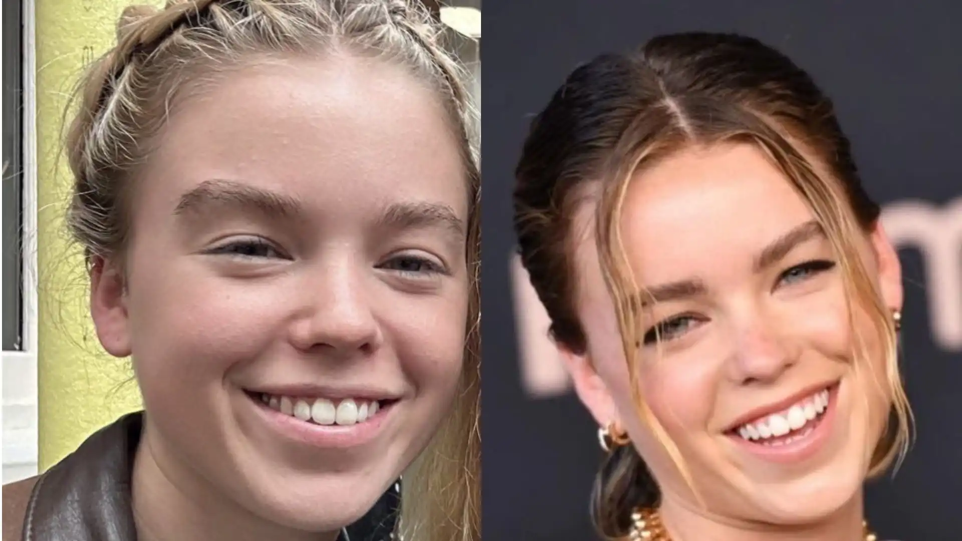 Milly Alcock's teeth