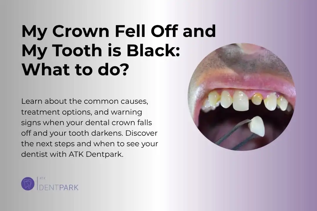 My Crown Fell Off and My Tooth is Black: What to do?