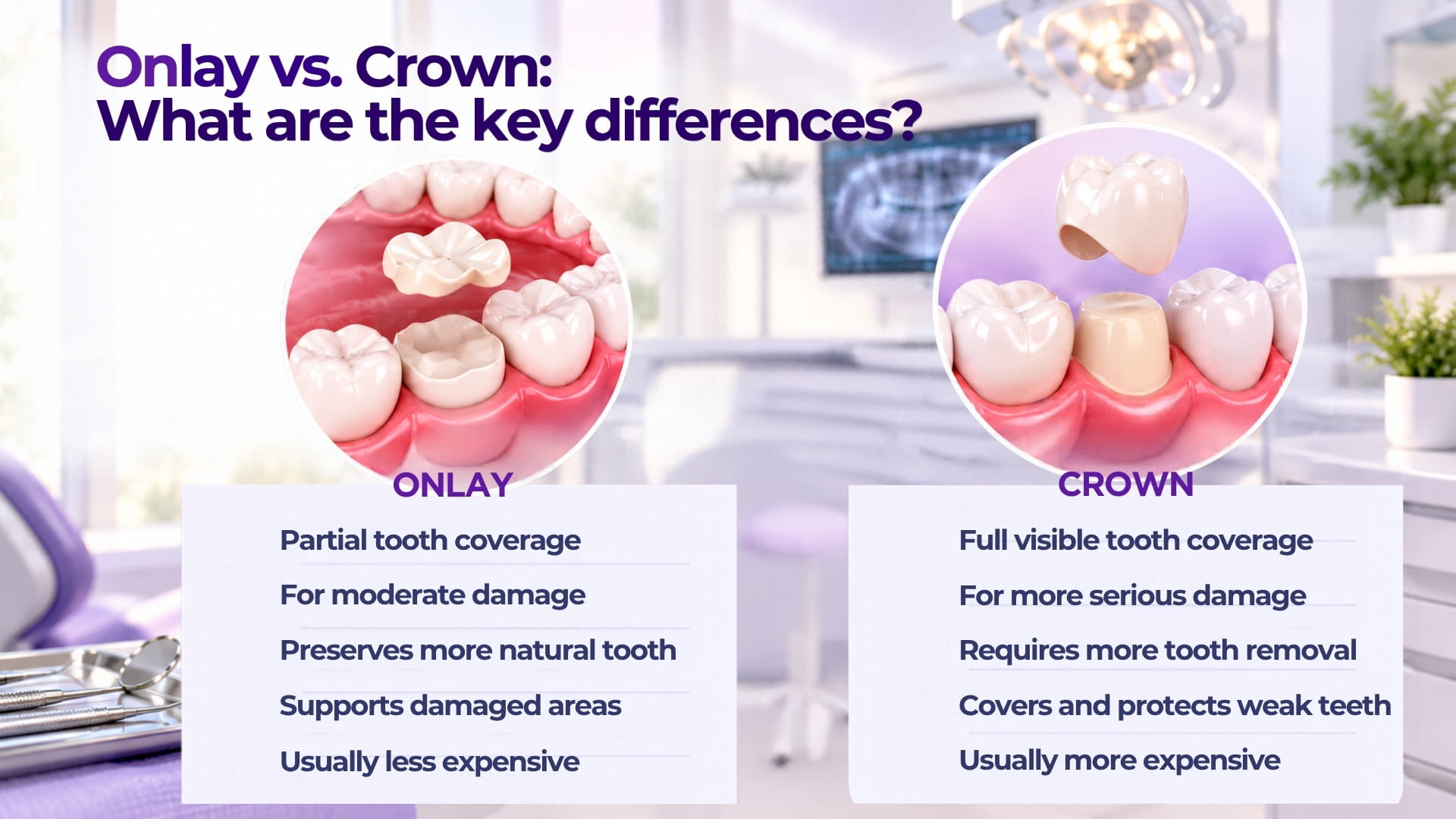 Onlay vs. crown: What are the key differences?