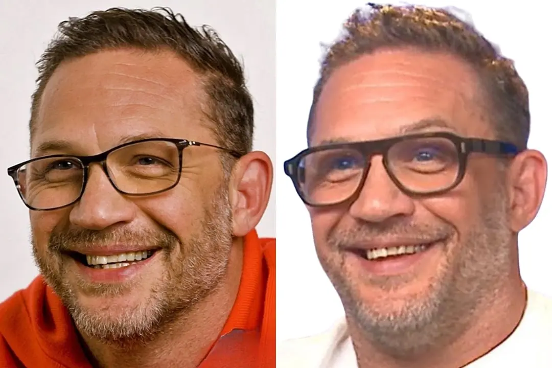 Tom Hardy teeth 2024