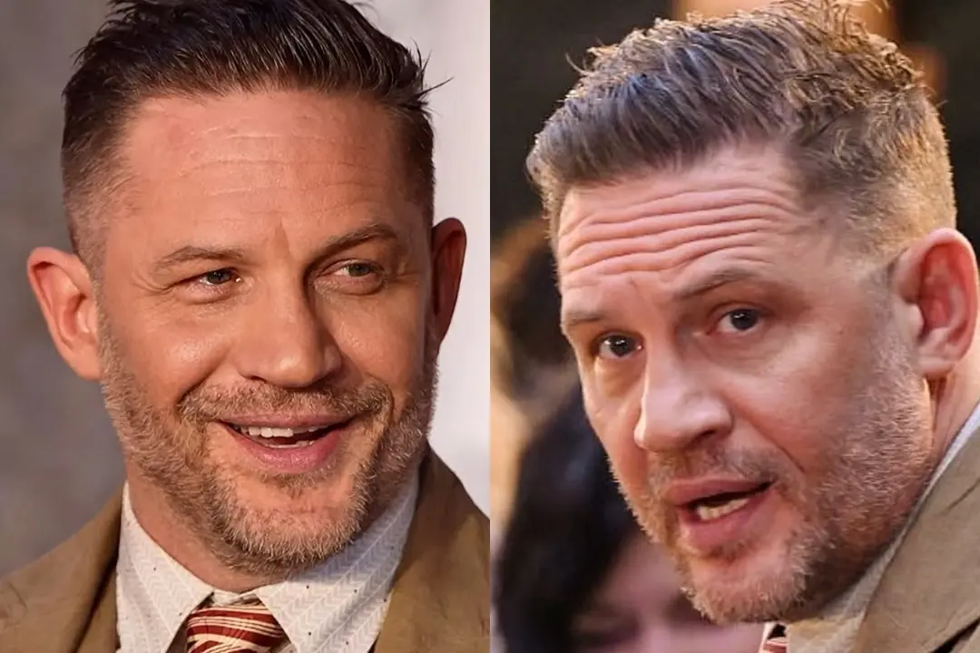 Tom Hardy teeth in 2025